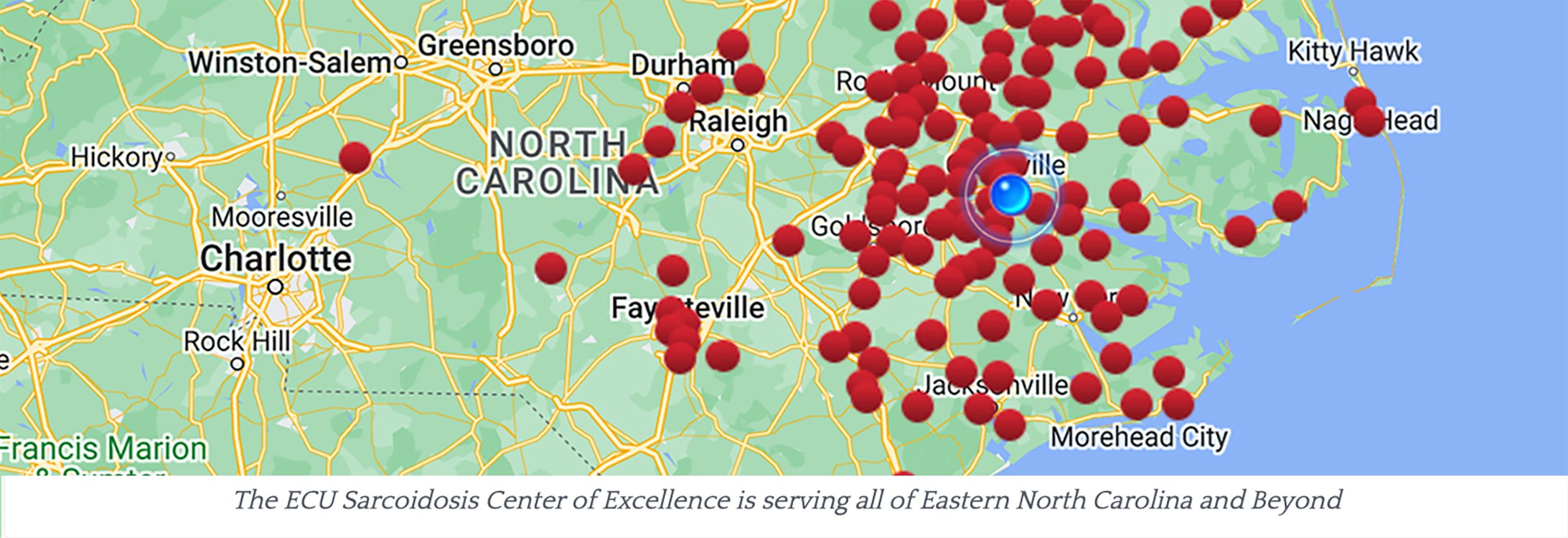 The ECU Sarcoidosis Center of Excellnce is serving all of Eastern North Carolina and Beyond